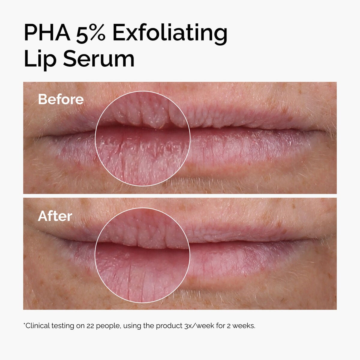 pha-5-exfoliating-lip-serum-h4 ord-pha-5pct-lip-exfoliating-serum-before-after.jpg